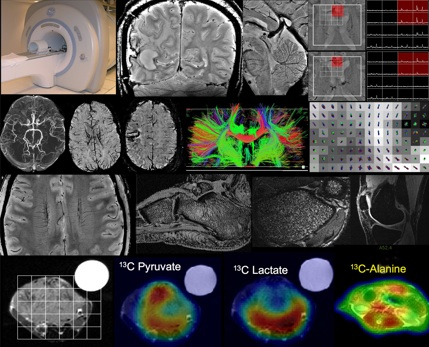 Advanced Imaging Techniques for Cirrhosis Assessment